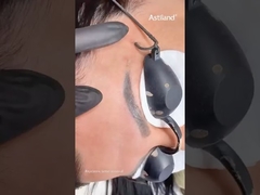 眉毛タトゥー除去用Nd Yagレーザー #ndyagレーザー #タトゥー除去レーザー #美容機器 #レーザークリニック