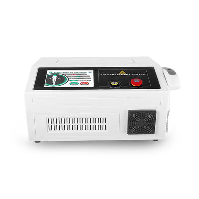 ISO 532nmの顔料QはND Yagレーザー機械を転換した